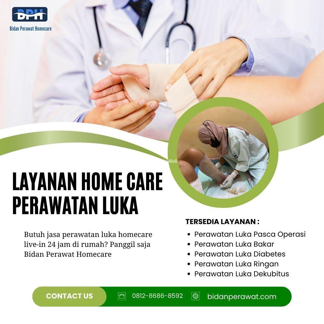 Perawatan luka Bakar Homecare
