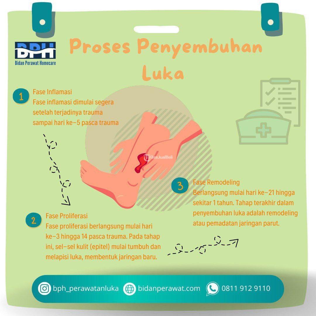 Perawatan luka Bakar Homecare