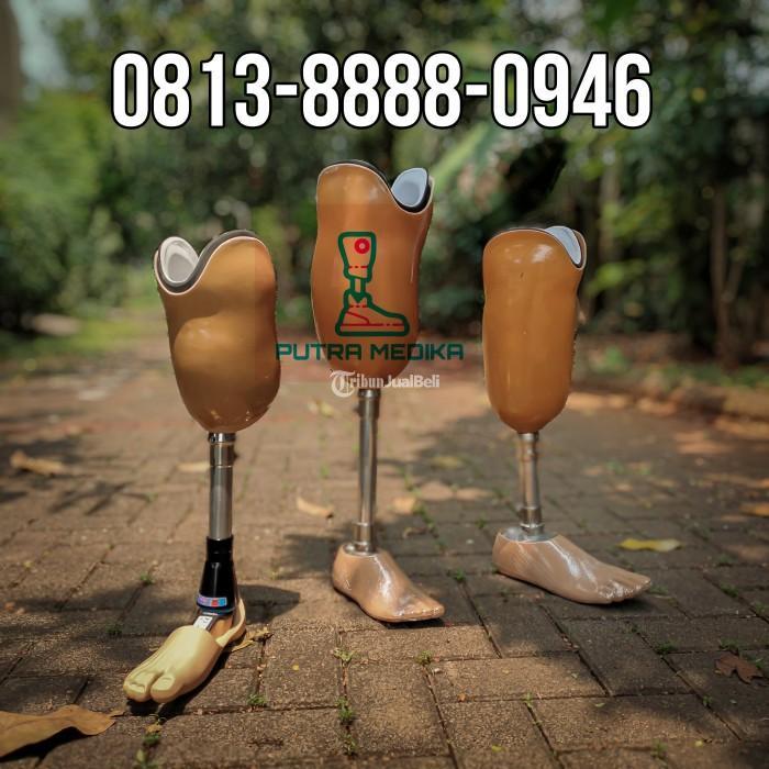 Pembuatan kaki palsu solo