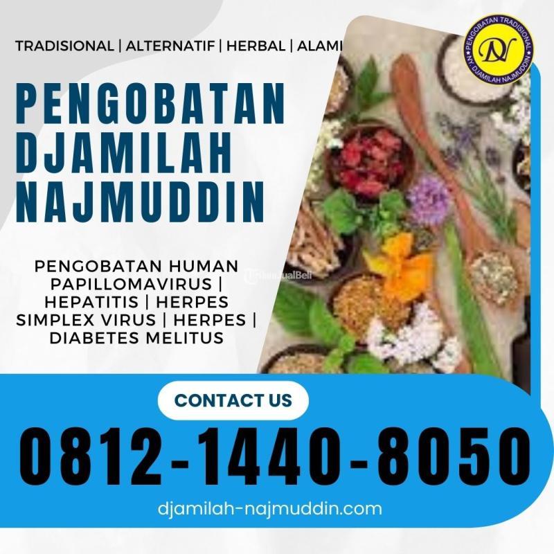 Pengobatan Hepatitis Alkoholik - ny. djamilah najmuddin