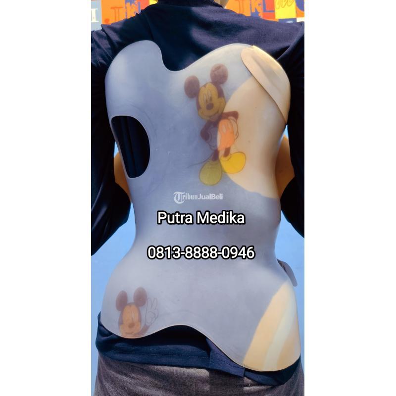 Brace Scoliosis Mengatasi Kelengkungan Tulang Belakang - Solo Jawa Tengah