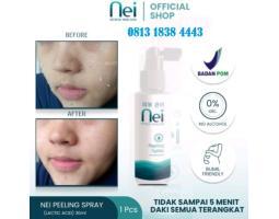 Nei Peeling Spray Penghilang Daki 90 Ml Ready - Lhokseumawe