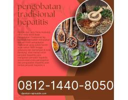  Pengobatan Hepatitis Pada Anak Ny. Djamilah - Bandung 