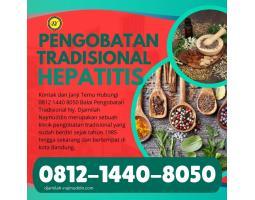 Pengobatan Hepatitis B Pada Anak Ny. Djamilah Najmuddin - Bandung 