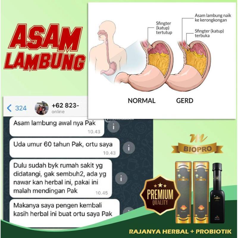 MBiopro Herbal Alami Obat Asam Lambung Mujarab - Mojokerto