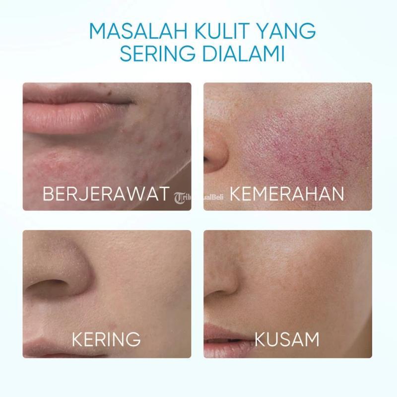 Reglow Moisturizer Gel Memperbaiki Skin Barrier Melembapkan Maksimal - Surabaya