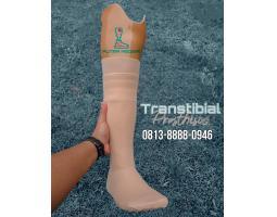 Pembuatan Kaki Palsu Riau Batam