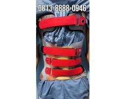 Pembuatan Scoliosis Brace Kalimantan
