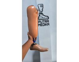 Pembuatan Kaki Palsu Samarinda