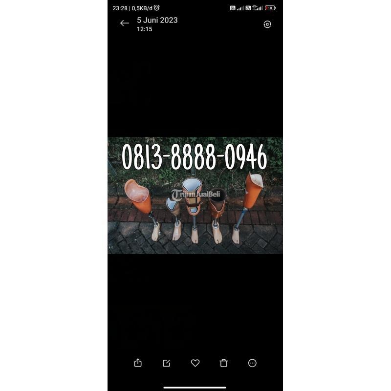 Jasa pembuatan kaki palsu