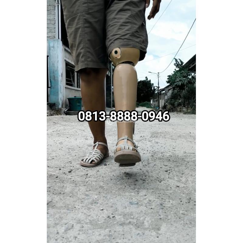 Penjual kaki Palsu Tasikmalaya