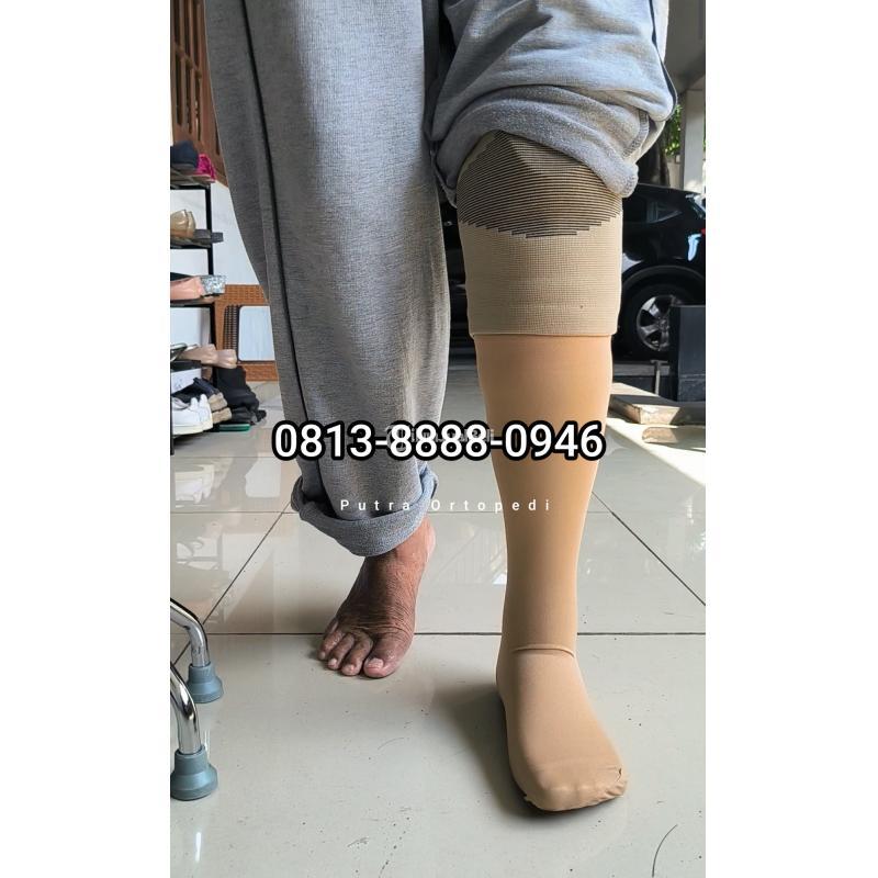 Pembuat Kaki Palsu di Balikpapan