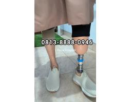 Pembuat Kaki Palsu di Balikpapan