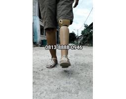 Penjual kaki Palsu Bangka Belitung