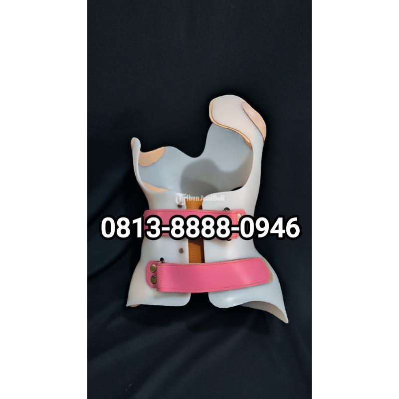 Pembuatan Brace Skoliosis Sumedang Indramayu Tasikmalaya Banjar