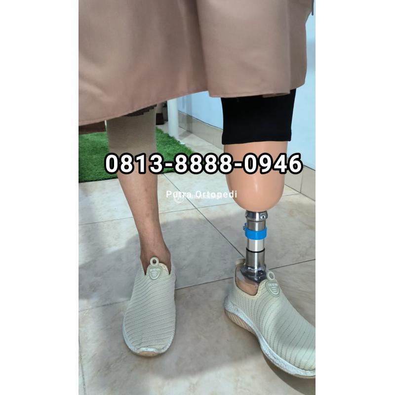 Pembuat Kaki Palsu Indramayu Sumedang Tasikmalaya Kuninga Banjarn Subang