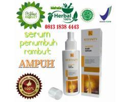 KERANITY Asli Original Atasi Rambut Botak Dan Rontok Secara Alami 081318384443