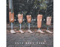 Kaki palsu Banjarmasin