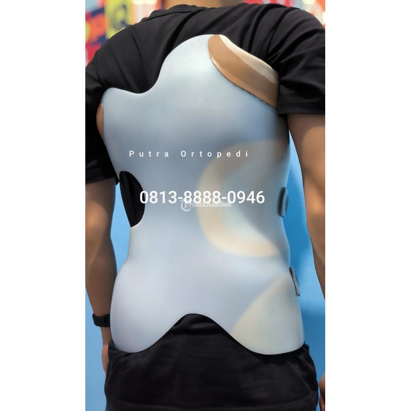 Pembuat Brace Skoliosis Tasikmalaya Sumedang Garut Banjar