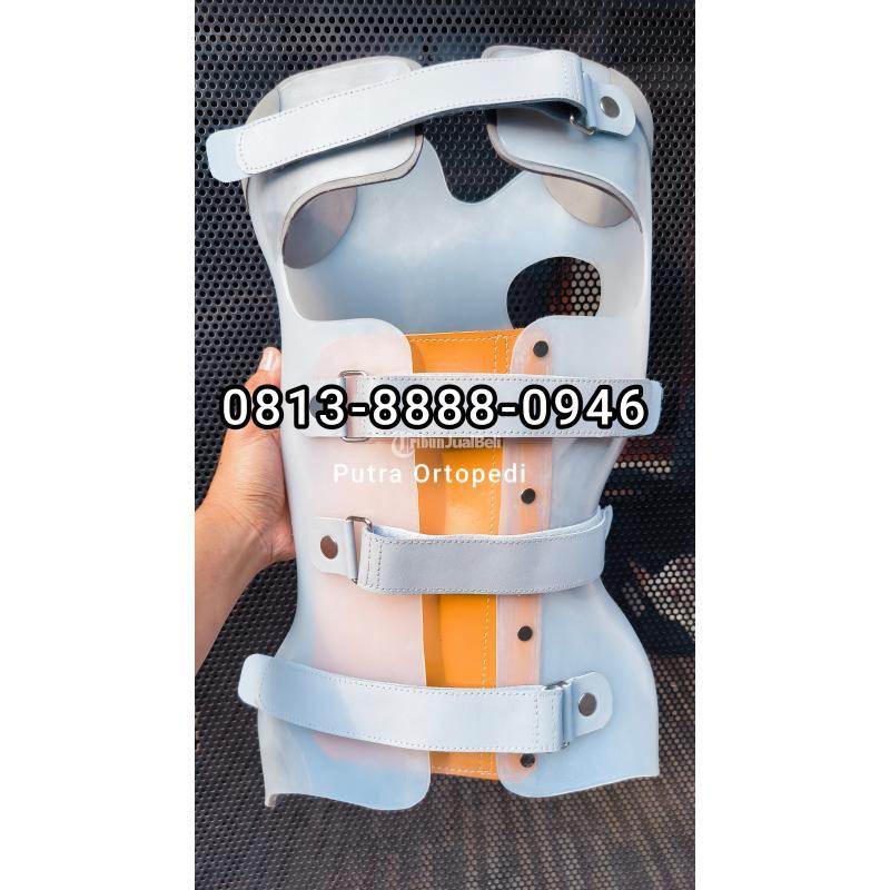 Pembuat Brace Skoliosis Tasikmalaya Sumedang Garut Banjar