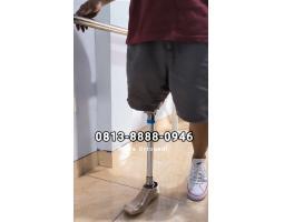 Pembuat Kaki Palsu di Jambi