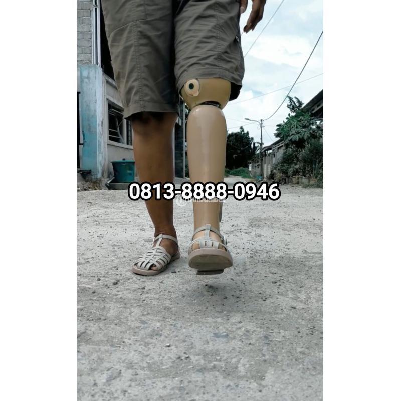 Pembuat Kaki Palsu Putra Medika - Batam Kepulauan Riau