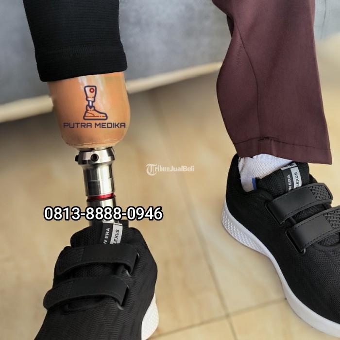 Pembuat Kaki Palsu Sumedang