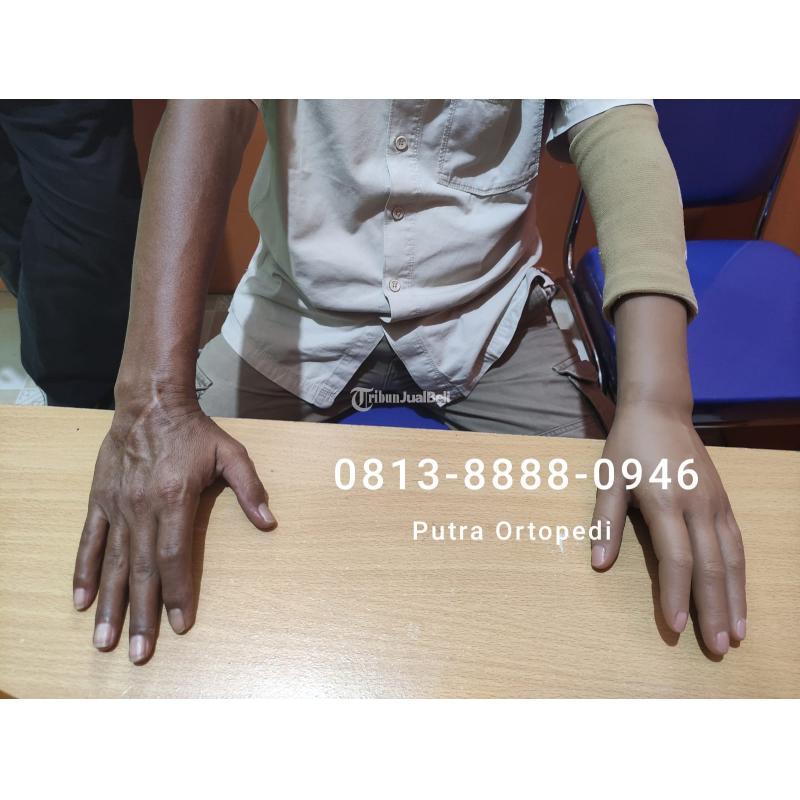 Tangan Palsu Berkulitas Sudah Berpengalaman Haga Kompetitif - Jakarta Timur