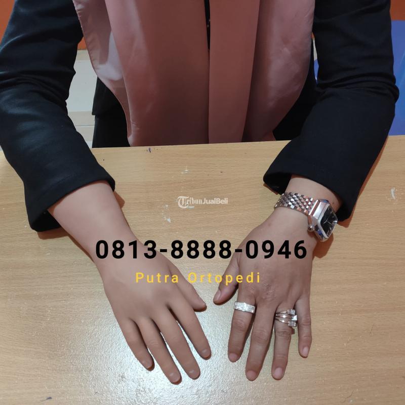 Tangan Palsu Berkulitas Sudah Berpengalaman Haga Kompetitif - Jakarta Timur