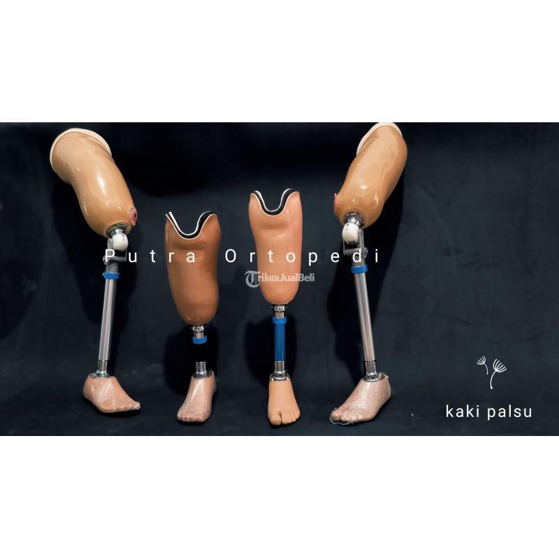 Kaki Palsu Atas Lutut Ditangani Tenaga Medis Profesional Berpengalaman 13 Tahun - Jakarta Utara