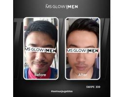 Ms Glow For Men Skincare Di Khususkan Untuk Para Pria Bpom Paket Lengkap - Surabaya Jawa Timur