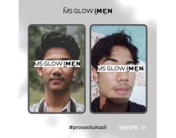 MS Glow For Men Basic Perawatan Untuk Para Pria BPOM - Surabaya Jawa Timur