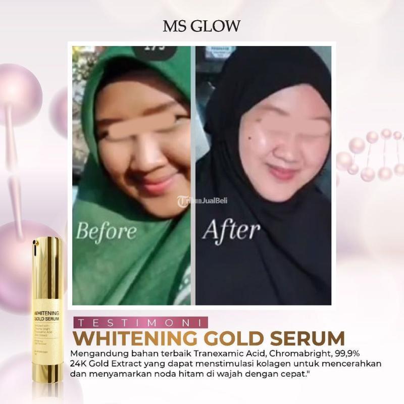 Ms Glow Serum Whitening Gold Mencerahkan Mencegah Penuaan Dini Free