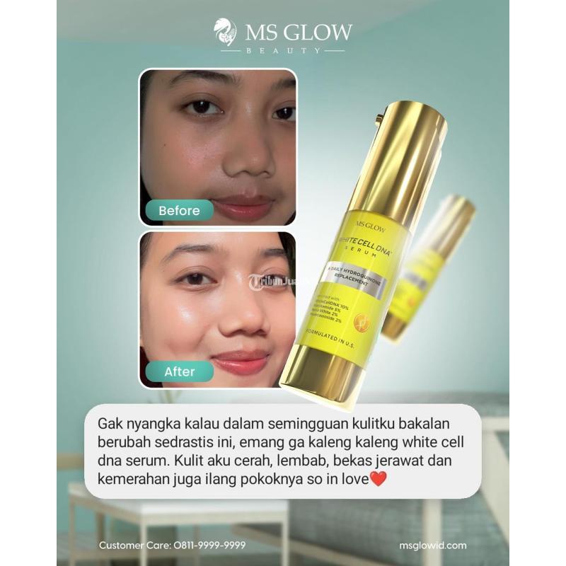 MS Glow Serum White Cell DNA - Surabaya Jawa Timur