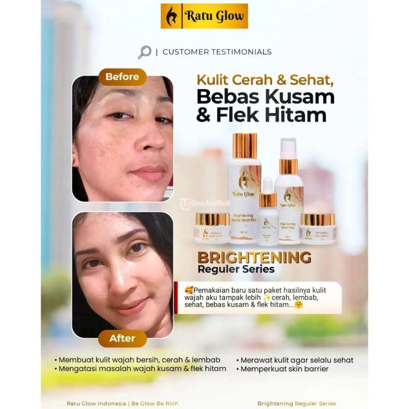 Ratu Glow Paket Reguler Acne - Surabaya Jawa Timur