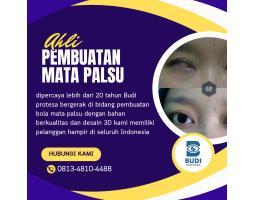 Pembuatan Mata Palsu Budi Protesa - Semarang Jawa Tengah