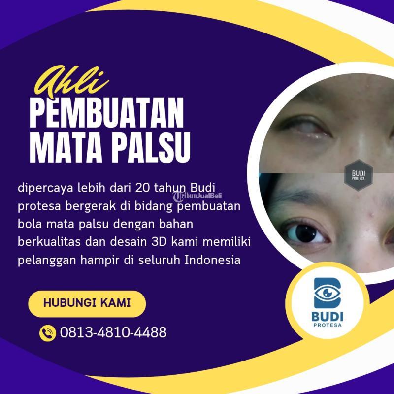Pembuatan Mata Palsu Budi Protesa - Semarang Jawa Tengah