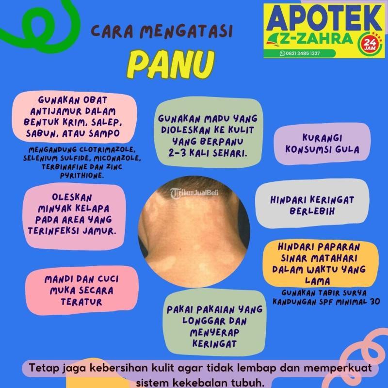Obat Panu Cina Paling Ampuh Apotek AzZahra 24 Jam Dekat Sini - Bantul Yogyakarta