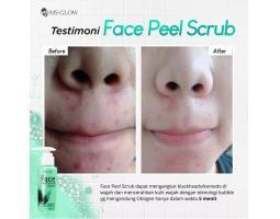 Ms Glow Face Peel Penghilang Komedo Ampuh - Surabaya Jawa Timur