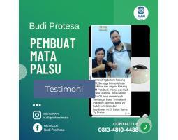 Pembuat Mata Palsu Protesa, Mata Berkualitas - Pemalang