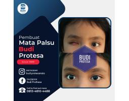 Jasa Pembuat Bola Mata Palsu, Berkualitas 3D, Terpercaya - Sragen
