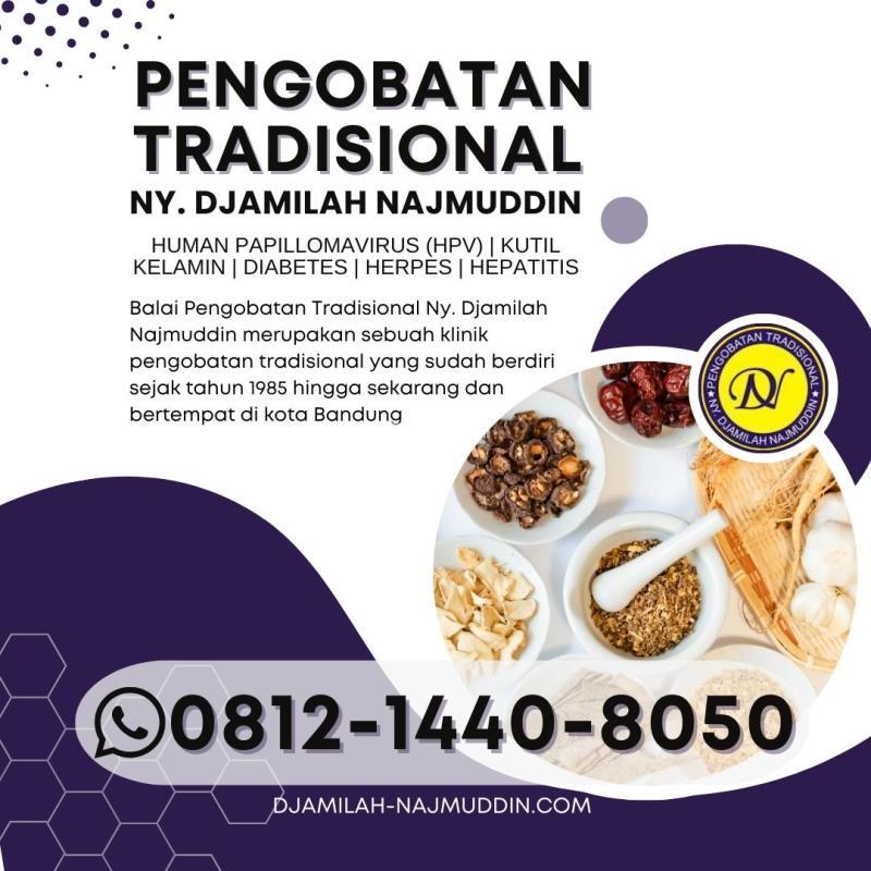 Jasa Pengobatan Tradisional, Ny. Djamilah Najmuddin - Bandung