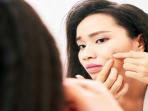 Begini Akibatnya Jika Anda Kerap Pencet Jerawat di Wajah Secara Paksa. Stop dari Sekarang!
