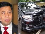 Beredar Foto 'Benjolan Bakpao' Milik Setya Novanto Ketika Buka Perban! Ukurannya Cuma Segini?