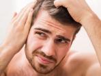 Rambut Anda Rontok dan Botak Pada Area Tertentu? Bisa Jadi Itu Tanda dari Penyakit Ini, Segera Atasi dengan Cara Ini!