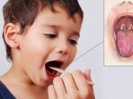 Jadi 'Momok' Menakutkan, Inilah 8 Penyebab Menularnya Wabah Difteri yang Perlu Diwaspadai, Nomor 2 dan 3 Jadi Kebiasaan !