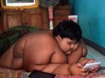 Awalnya Punya Berat Badan Normal, Tak Disangka 3 Hal Ini Jadi Penyebab Arya Permana Punya Bobot Hingga 190 Kg