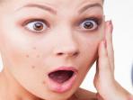 Sedang Berjerawat, Oleskan Saja Pasta Gigi! Begini Caranya yang Benar