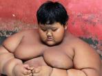 Sempat Punya Berat Badan 192 Kg, Begini Kabar Terbaru Bocah Pengidap Obesitas di Karawang, Penampilannya Bikin Pangling!