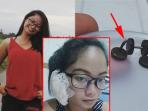Menyedihkan, Gara - Gara Bergaya Menggunakan Anting Murah, Wanita Ini Harus Rela Telinganya Menjadi Seperti Ini!